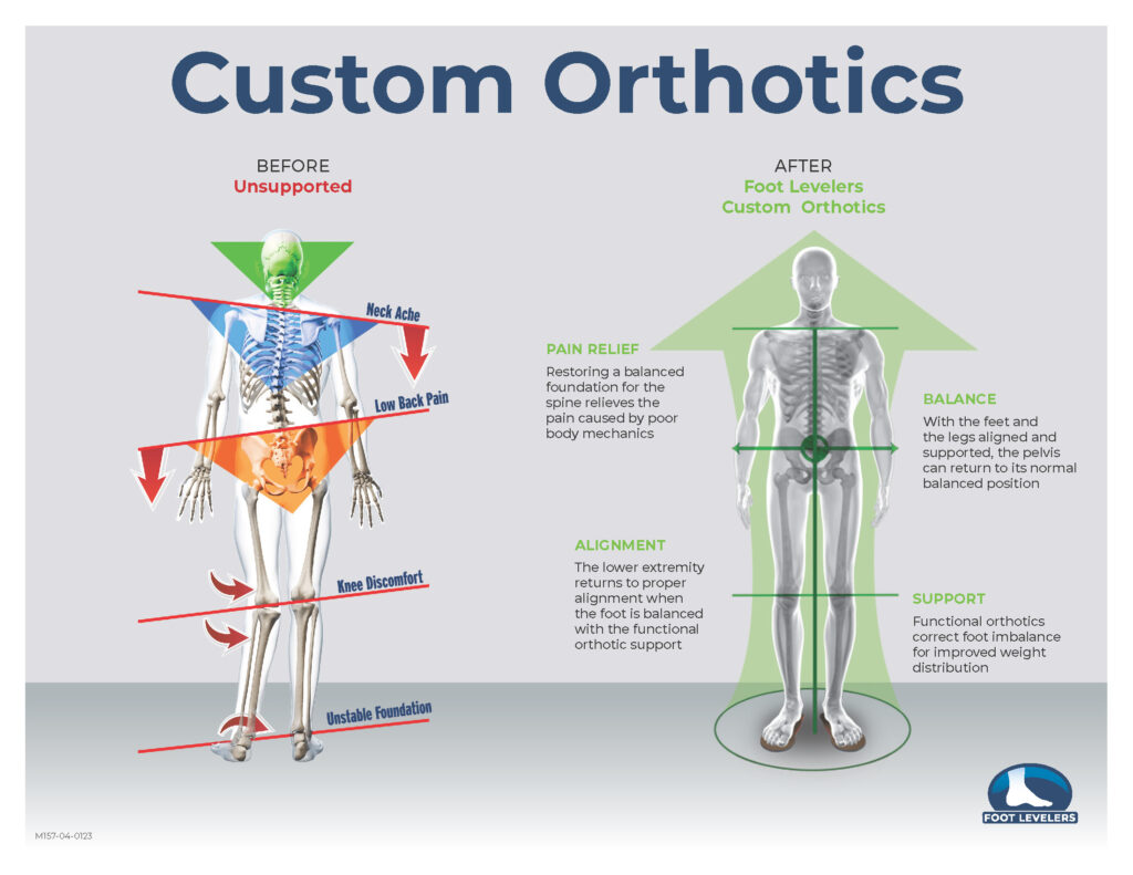 Custom Orthotics