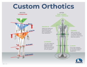Custom Orthotics